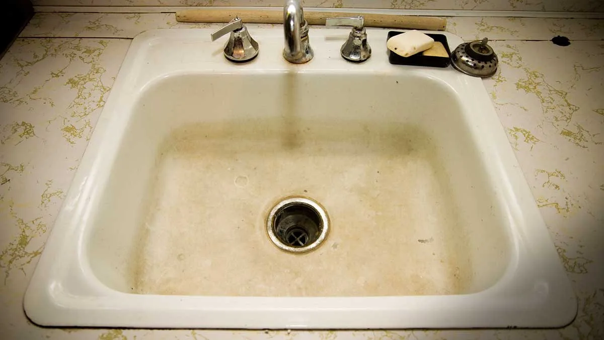 Una compressa e acqua calda e l’ostruzione sparisce come se non fosse mai esistita: il consiglio dell’idraulico